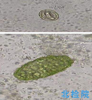 寄生蟲檢驗