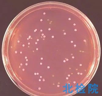 麥康凱瓊脂培養基測試