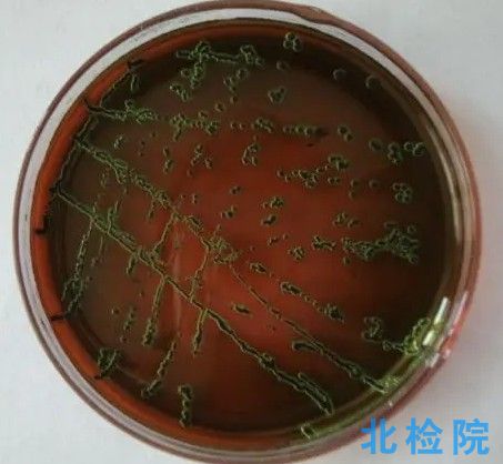 淋球菌瓊脂基礎培養基測試
