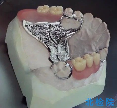 義齒穩固劑測試