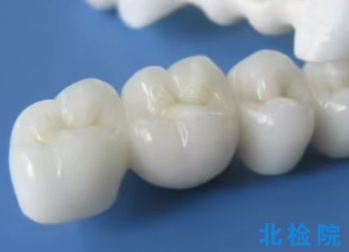 牙科學鑄造金合金測試
