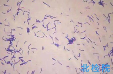 放線菌檢測