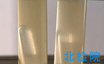 發酵酸檢測
