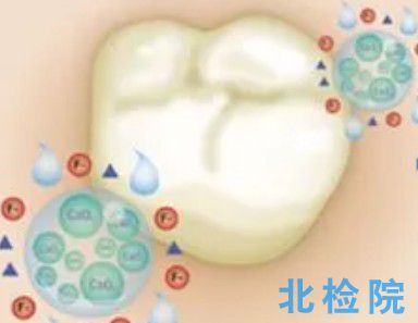牙科氟化物檢測