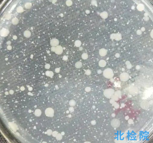 菌落總數檢測
