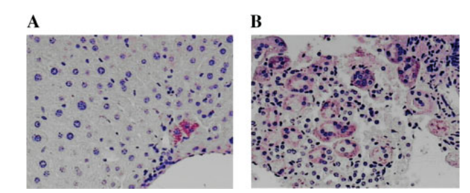 HBV-1.png