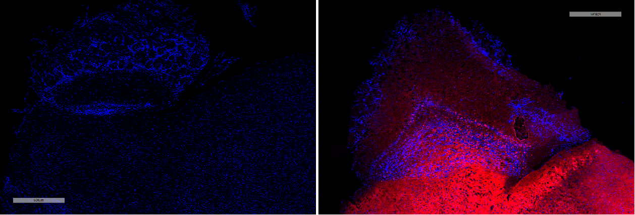 sst-cre-3.png