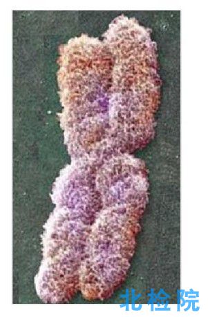 植物染色體